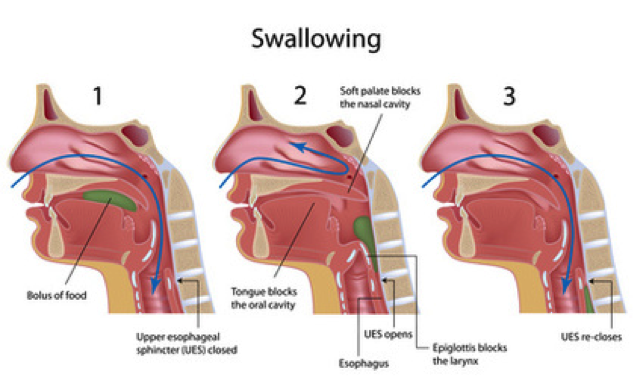 The Path of Food During a Swallow: A Journey Through the Pharynx